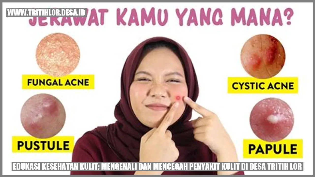 Edukasi Kesehatan Kulit: Mengenali dan Mencegah Penyakit Kulit di Desa Tritih Lor
