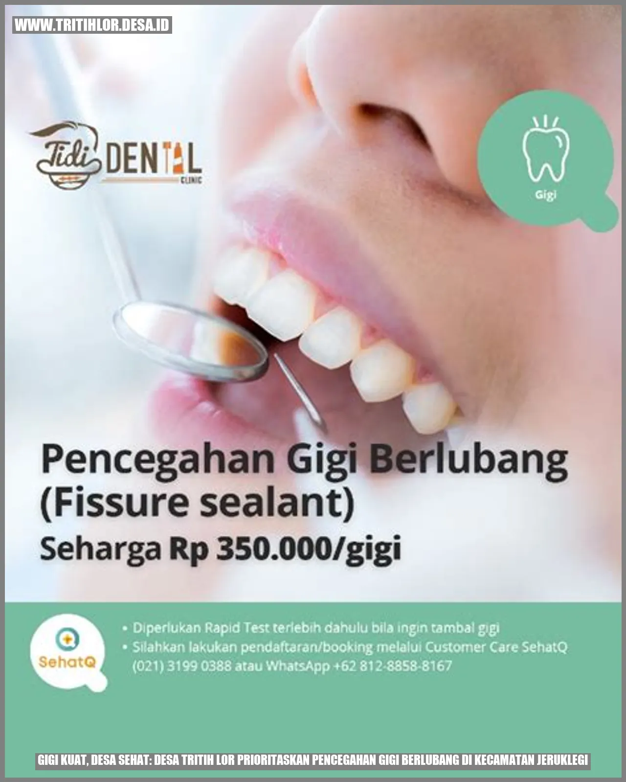 Gigi Kuat, Desa Sehat: Desa Tritih Lor Prioritaskan Pencegahan Gigi Berlubang di Kecamatan Jeruklegi